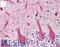 SNCG antibody, LS-B2968, Lifespan Biosciences, Immunohistochemistry paraffin image 
