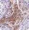 V-Set And Immunoglobulin Domain Containing 1 antibody, FNab09454, FineTest, Immunohistochemistry frozen image 