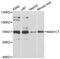 Mannosidase Alpha Class 1C Member 1 antibody, A12837, ABclonal Technology, Western Blot image 