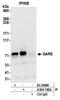 Glycyl-TRNA Synthetase antibody, A304-746A, Bethyl Labs, Immunoprecipitation image 