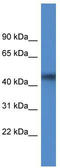 1-Acylglycerol-3-Phosphate O-Acyltransferase 4 antibody, TA343074, Origene, Western Blot image 