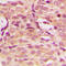 Akt antibody, LS-C353925, Lifespan Biosciences, Immunohistochemistry paraffin image 