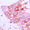 Mucin 13, Cell Surface Associated antibody, LS-C353502, Lifespan Biosciences, Immunohistochemistry paraffin image 
