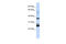 Transmembrane Protein 255A antibody, 26-216, ProSci, Western Blot image 