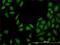 Methylthioadenosine Phosphorylase antibody, H00004507-M01, Novus Biologicals, Immunocytochemistry image 