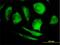 Phytanoyl-CoA dioxygenase, peroxisomal antibody, H00005264-B01P, Novus Biologicals, Immunofluorescence image 