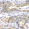 p53 antibody, A5804, ABclonal Technology, Immunohistochemistry paraffin image 