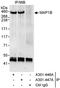 Microtubule Associated Protein 1B antibody, A301-447A, Bethyl Labs, Immunoprecipitation image 