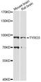 TYRO3 Protein Tyrosine Kinase antibody, LS-C749265, Lifespan Biosciences, Western Blot image 