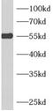 Adenylosuccinate Lyase antibody, FNab00161, FineTest, Western Blot image 