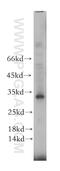 Receptor Transporter Protein 1 antibody, 18973-1-AP, Proteintech Group, Western Blot image 