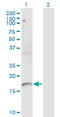 Plexin A2 antibody, LS-C197928, Lifespan Biosciences, Western Blot image 