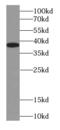 Nucleophosmin 1 antibody, FNab00759, FineTest, Western Blot image 