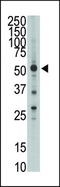 HtrA Serine Peptidase 1 antibody, TA324517, Origene, Western Blot image 