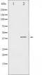 NF-kappa-B inhibitor alpha antibody, TA325729, Origene, Western Blot image 
