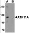 ATPase Phospholipid Transporting 11A antibody, orb94560, Biorbyt, Western Blot image 