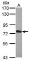 Zinc Finger Protein 417 antibody, PA5-31729, Invitrogen Antibodies, Western Blot image 