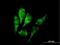 Dihydrolipoamide S-Succinyltransferase antibody, H00001743-B01P, Novus Biologicals, Immunofluorescence image 