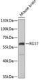 Regulator of G-protein signaling 7 antibody, GTX64703, GeneTex, Western Blot image 