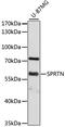 SprT-Like N-Terminal Domain antibody, 14-070, ProSci, Western Blot image 