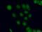Protein Phosphatase, Mg2+/Mn2+ Dependent 1D antibody, 26532-1-AP, Proteintech Group, Immunofluorescence image 