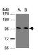 Metabotropic glutamate receptor 3 antibody, PA5-28767, Invitrogen Antibodies, Western Blot image 
