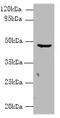 Carboxypeptidase A2 antibody, A58646-100, Epigentek, Western Blot image 