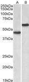 Vasodilator Stimulated Phosphoprotein antibody, 43-655, ProSci, Western Blot image 