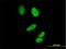 Cyclin H antibody, H00000902-B01P, Novus Biologicals, Immunofluorescence image 