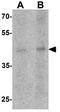 LIM Homeobox Transcription Factor 1 Alpha antibody, GTX31507, GeneTex, Western Blot image 