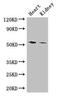 Cytochrome P450 Family 11 Subfamily B Member 1 antibody, orb45806, Biorbyt, Western Blot image 