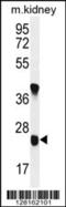 Unc-119 Lipid Binding Chaperone B antibody, 55-571, ProSci, Western Blot image 
