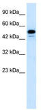 Cyclin Dependent Kinase 8 antibody, TA330372, Origene, Western Blot image 