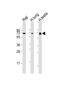 HERV-K_1q22 provirus ancestral Env polyprotein antibody, M15907, Boster Biological Technology, Western Blot image 