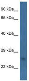 Coiled-Coil-Helix-Coiled-Coil-Helix Domain Containing 6 antibody, TA342948, Origene, Western Blot image 