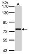 Calpain 5 antibody, LS-C185977, Lifespan Biosciences, Western Blot image 
