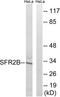 Serine/arginine-rich splicing factor 8 antibody, LS-C120419, Lifespan Biosciences, Western Blot image 