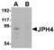 Junctophilin 4 antibody, LS-B4166, Lifespan Biosciences, Western Blot image 