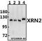 5'-3' Exoribonuclease 2 antibody, A02797-1, Boster Biological Technology, Western Blot image 