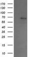 Sentrin-specific protease 2 antibody, CF504867, Origene, Western Blot image 