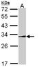 Nuclear Receptor Subfamily 0 Group B Member 2 antibody, LS-C186332, Lifespan Biosciences, Western Blot image 