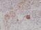 MART1 antibody, M02033-2, Boster Biological Technology, Immunohistochemistry frozen image 