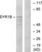 Dual Specificity Tyrosine Phosphorylation Regulated Kinase 1B antibody, TA312171, Origene, Western Blot image 