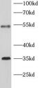 Solute Carrier Family 7 Member 11 antibody, FNab10533, FineTest, Western Blot image 