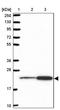 Ribosomal Protein L18 antibody, PA5-61252, Invitrogen Antibodies, Western Blot image 