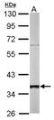 Small Glutamine Rich Tetratricopeptide Repeat Containing Alpha antibody, NBP1-31304, Novus Biologicals, Western Blot image 