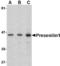 Presenilin 1 antibody, TA306424, Origene, Western Blot image 