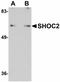 SHOC2 Leucine Rich Repeat Scaffold Protein antibody, LS-C108459, Lifespan Biosciences, Western Blot image 
