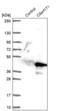 Cilia And Flagella Associated Protein 77 antibody, PA5-54385, Invitrogen Antibodies, Western Blot image 