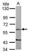 Rho Guanine Nucleotide Exchange Factor 3 antibody, PA5-30608, Invitrogen Antibodies, Western Blot image 